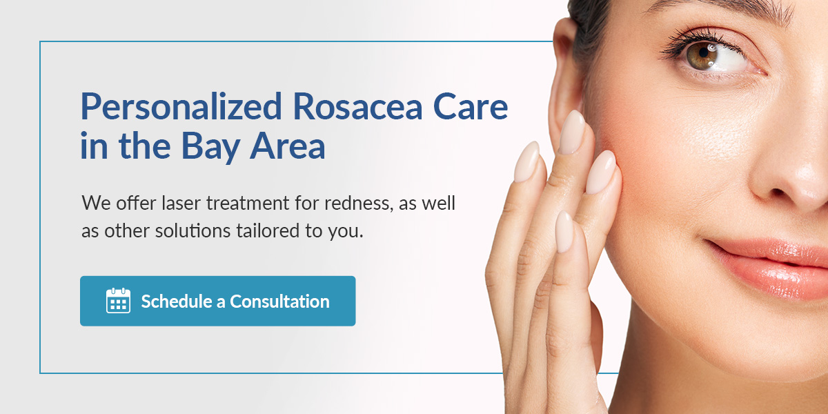 Personalized Rosacea Care in the Bay Area