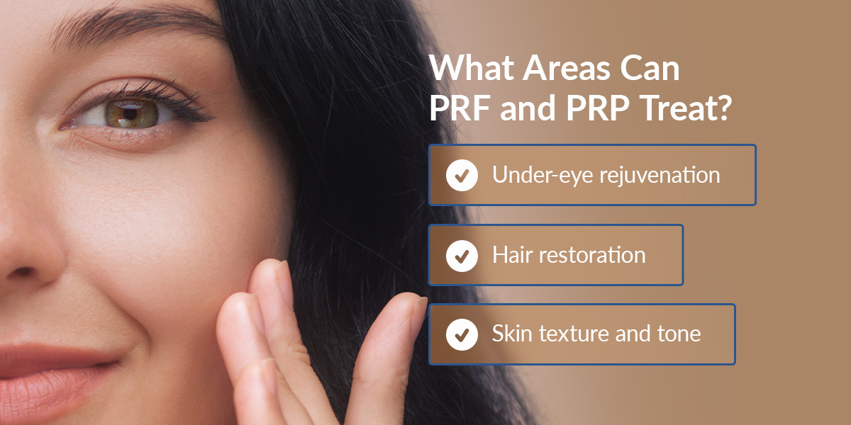 01 What Areas Can PRF And PRP Treat What Areas Can PRF and PRP Treat?