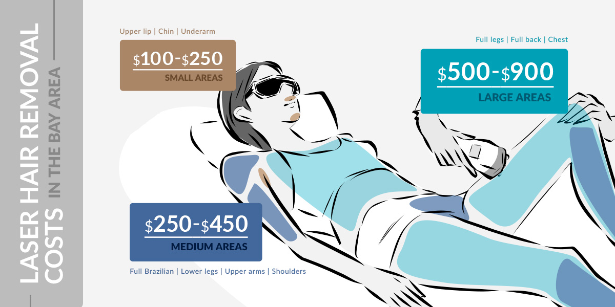 Understanding Laser Hair Removal Costs in the Bay Area