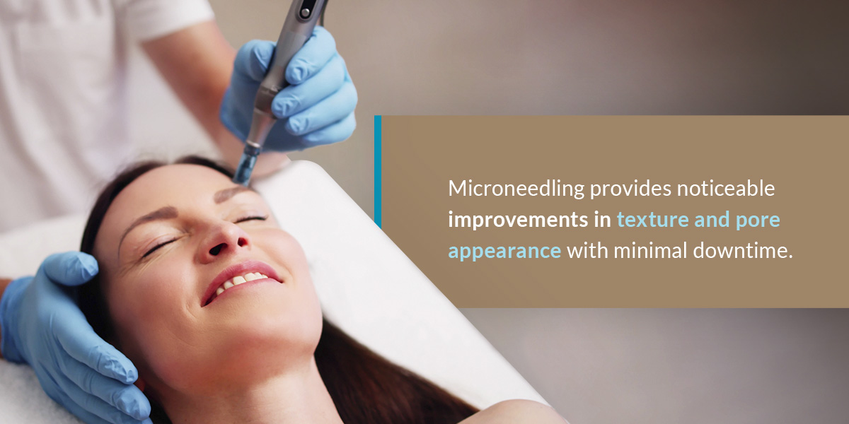 01 Microneedling provides noticeable improvements