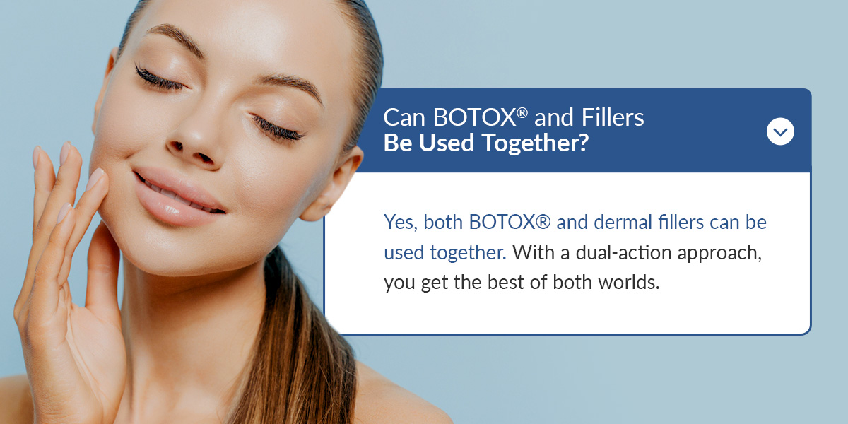 Can BOTOX® and Fillers Be Used Together? Can BOTOX® and Fillers Be Used Together?