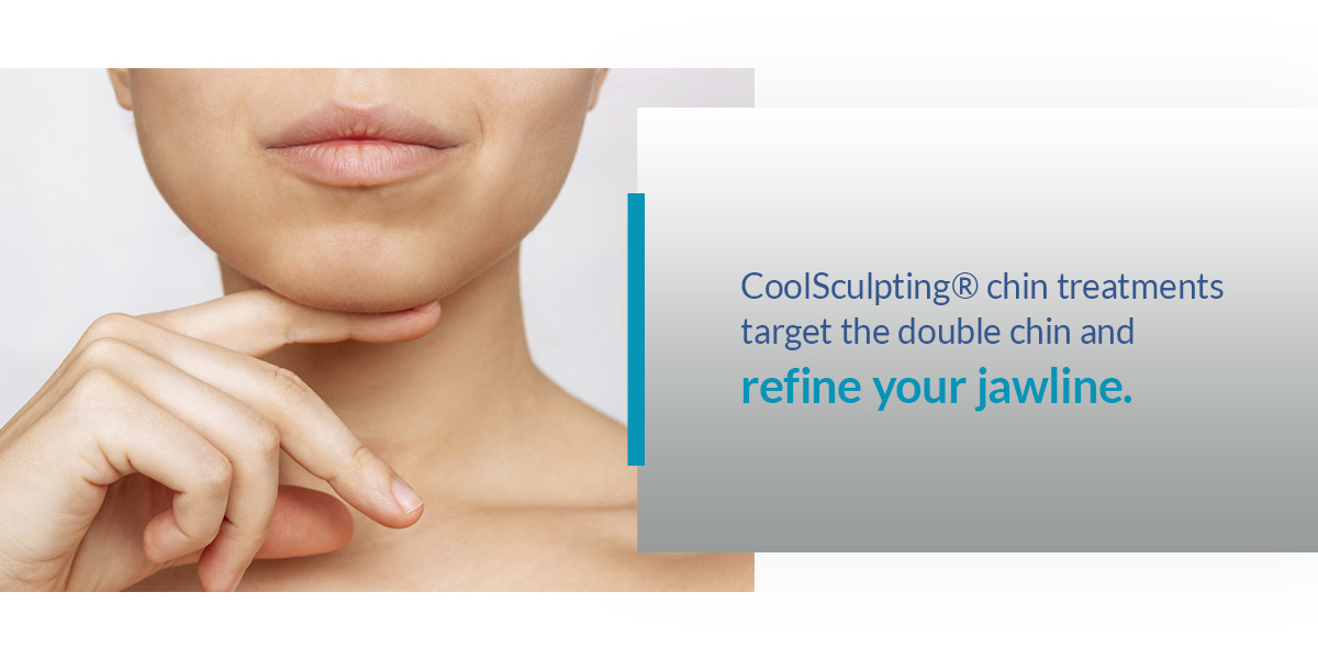 01 CoolSculptingr chin treatments 01 CoolSculptingr chin treatments