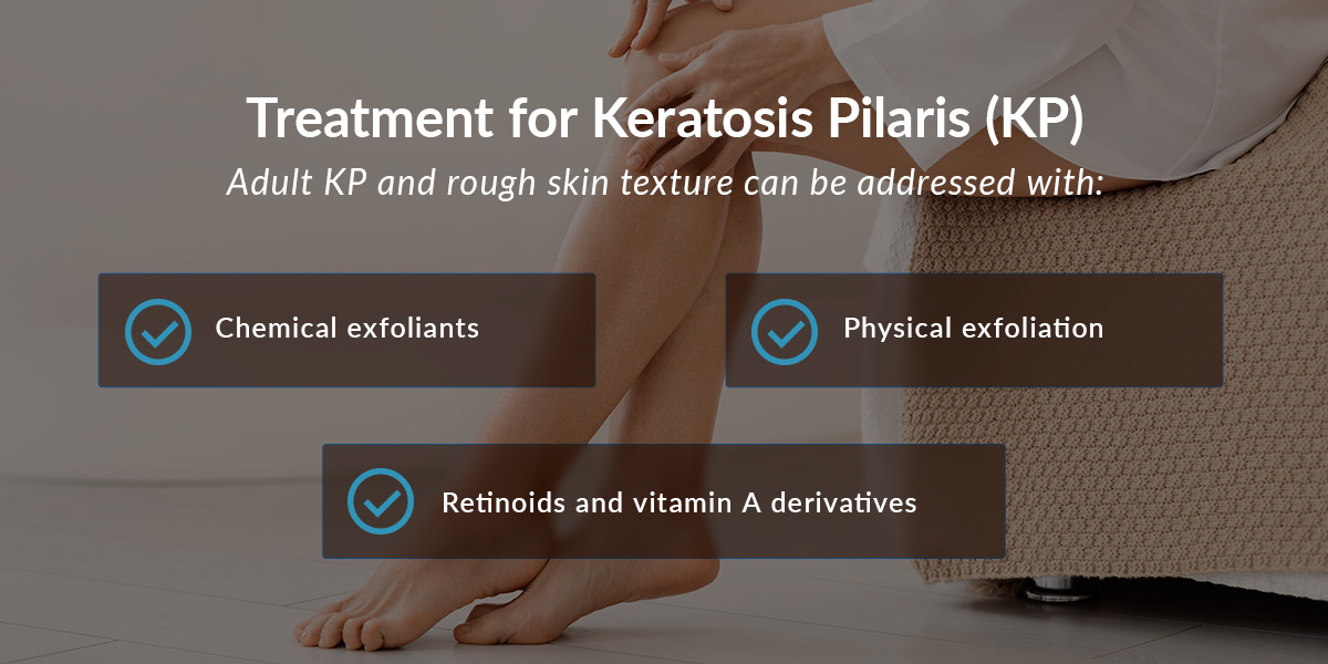 01 treatment for kp