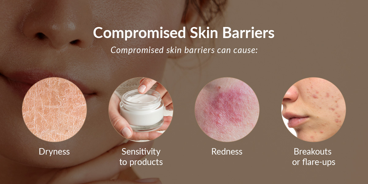 compromised skin barriers