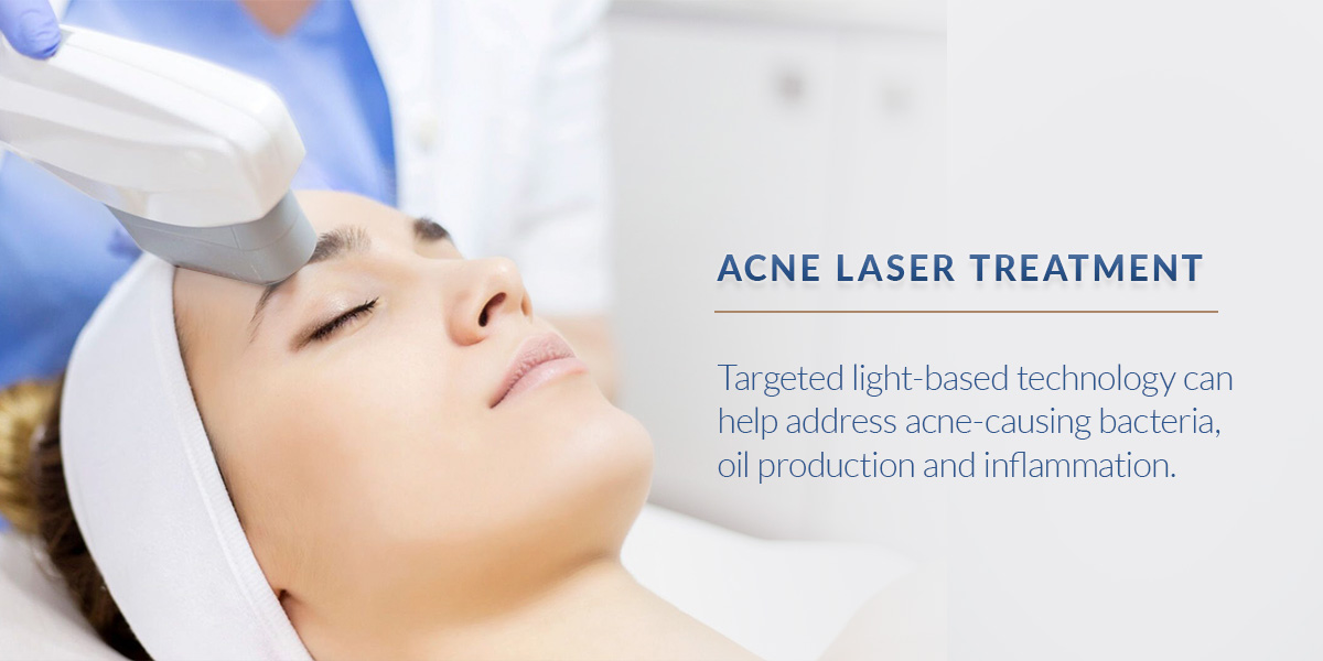 01 Acne laser treatment 01 Acne laser treatment
