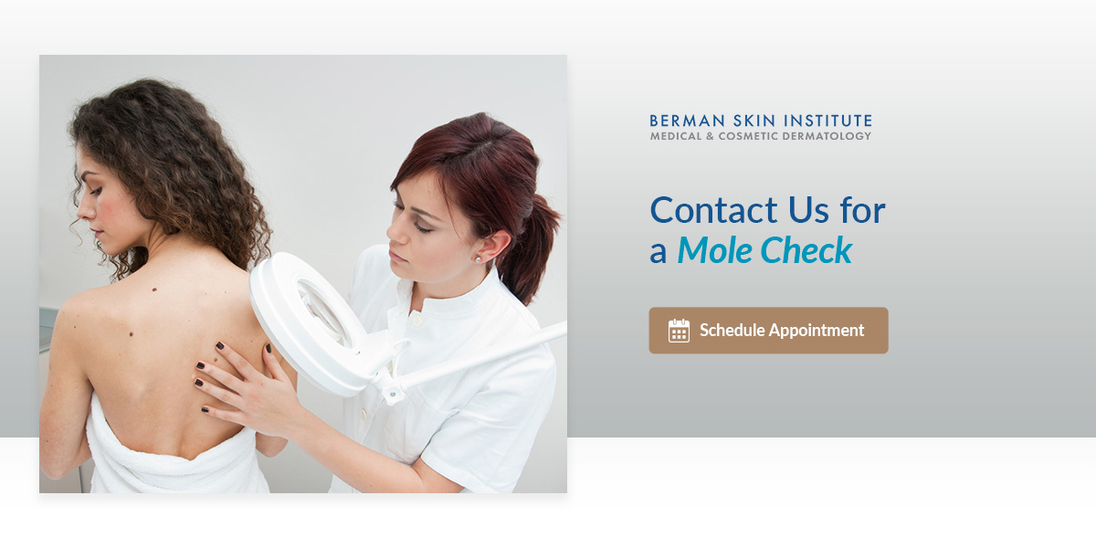 01 Contact Us for a Mole Check 01 Contact Us for a Mole Check