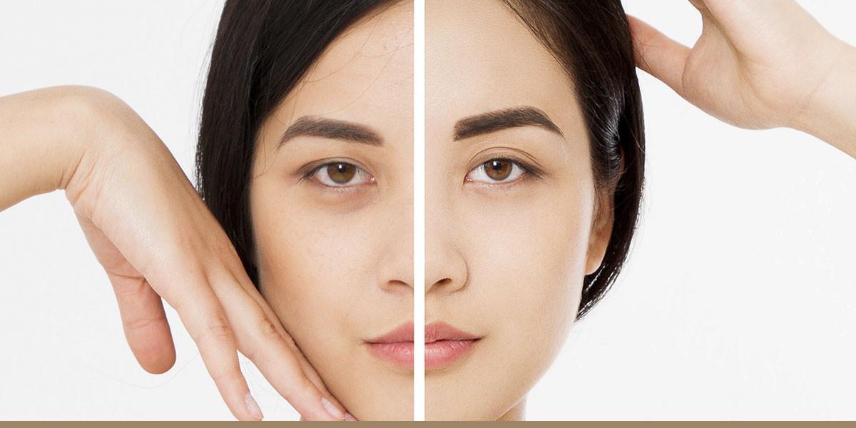 Learn whether a microdermabrasion or chemical peel is right for you.
