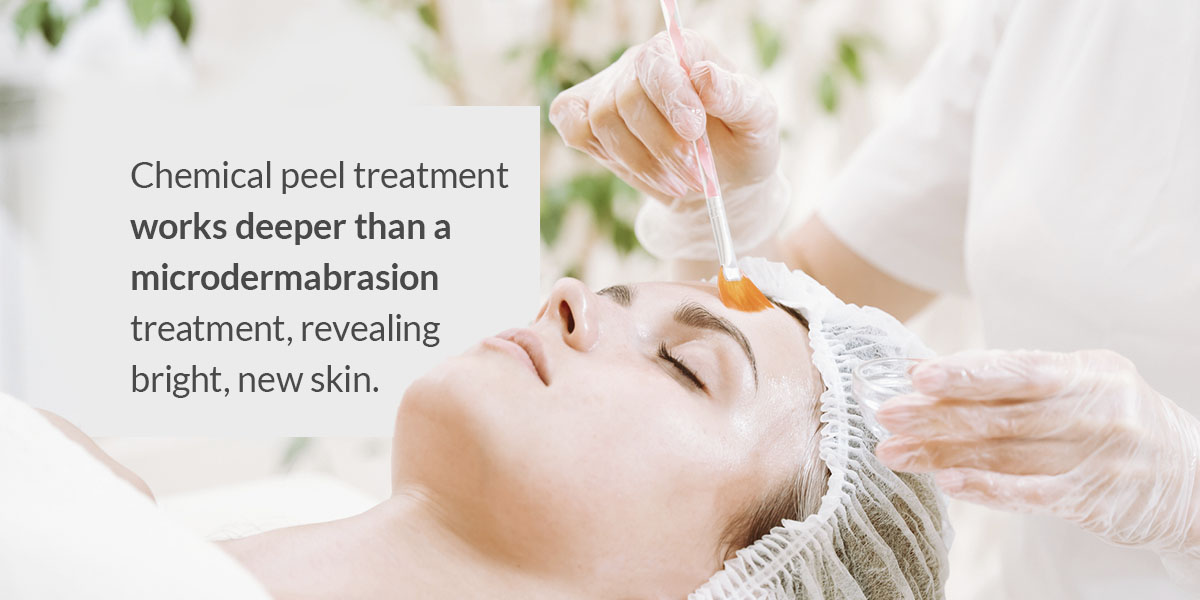 Chemical peel treatments work deeper than a microdermabrasion treatment, revealing bright, new skin.